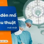 Báo Giá Đèn Mổ 2026 – Cập Nhật Bảng Giá Mới Nhất Theo Từng Loại